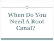 When Do You Need A Root Canal