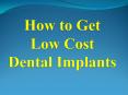 How to Get Low Cost Dental Implants