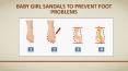 Baby girl sandals to prevent foot problems PowerPoint PPT Presentation