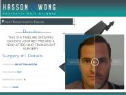 Hair Transplant Surgery