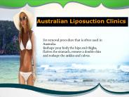 Liposuction Services in Sydney