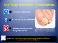 Risk Factors & Treatment of Toenail Fungus PowerPoint PPT Presentation