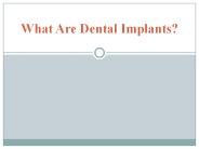 What Are Dental Implants