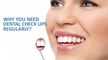 Why You Need Dental Check Up Regularly