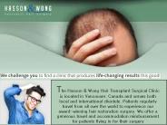 Financing Your Hair Transplant