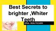 Best Secrets to brighter ,Whiter Teeth PowerPoint PPT Presentation