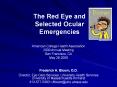 The Red Eye and Selected Ocular Emergencies PowerPoint PPT Presentation