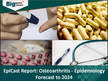 EpiCast Report: Osteoarthritis - Epidemiology Forecast to 2024
