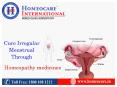 Homeopathy Treatment for PCOS | Homeocare International PowerPoint PPT Presentation