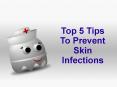 Top 5 Tips To Prevent Skin Infections PowerPoint PPT Presentation