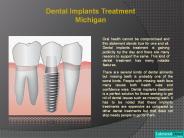 Dental implant specialist Michigan