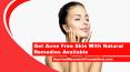Get Acne Free Skin With Natural Remedies Available PowerPoint PPT Presentation