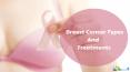 Breast Cancer Types And Treatments PowerPoint PPT Presentation