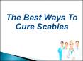 The Best Ways To Cure Scabies PowerPoint PPT Presentation