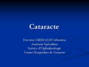 Cataracte