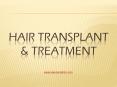Sai Cosmetic offers hair transplant and cosmetic surgery in Pune PowerPoint PPT Presentation