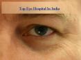 Top eye hospital in India PowerPoint PPT Presentation