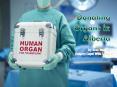 Donate Organ Through Calgary Legal Wills PowerPoint PPT Presentation