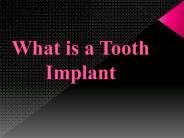 What is a Tooth Implant