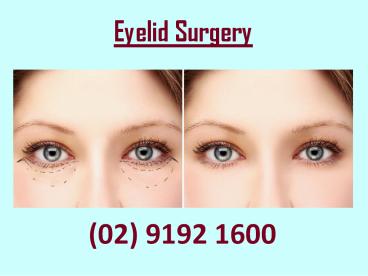 An Overview of Eyelid Surgery
