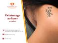 Traitement professionnel pour effacer un tatouage au laser PowerPoint PPT Presentation