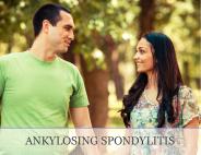 Ankylosing spondylitis