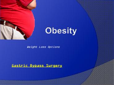 Gastric Bypass Surgery
