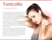 Torticollis