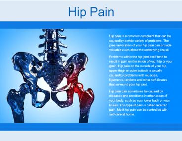 Hip Pain
