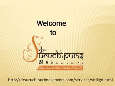 Cheapest Vitiligo Surgery Clinic in Delhi