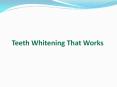 Teeth Whitening That Works PowerPoint PPT Presentation