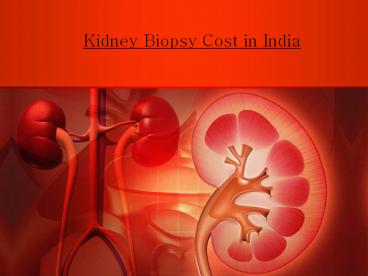 Kidney Biopsy in Delhi