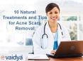 Natural Treatment's and Tips for Acne Scars Removal PowerPoint PPT Presentation