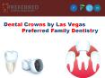 Dental Crowns by Las Vegas Preferred Family Dentistry PowerPoint PPT Presentation