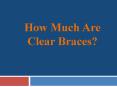 How Much Are Clear Braces? PowerPoint PPT Presentation