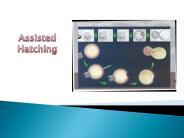 Assisted Hatching in India