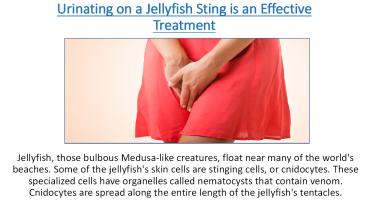 Urinating on a Jellyfish Sting is an Effective Treatment