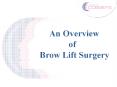 An overview of Brow Lift Surgery PowerPoint PPT Presentation