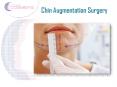 Chin Augmentation Surgery PowerPoint PPT Presentation