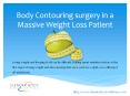 Body Contouring Surgery in a Massive Weight Loss Patient PowerPoint PPT Presentation