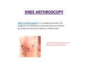 Knee Arthroscopic Surgery in India