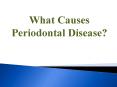 What Causes Periodontal Disease? PowerPoint PPT Presentation
