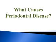 What Causes Periodontal Disease?