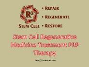 Mesenchymal PRP Stem Cell Therapy: R3stemcell