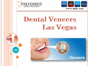Dental Veneers Las Vegas - Preferred Family Dentistry