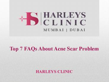 Top 7 FAQs About Acne Scar Problem