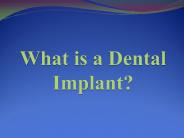 What is a Dental Implant?