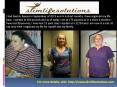Gastric bypass surgery PowerPoint PPT Presentation