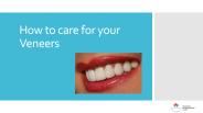 How to care for your Veneers