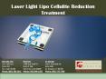 Laser Light Lipo Cellulite Reduction Treatment PowerPoint PPT Presentation
